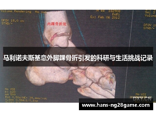 马利诺夫斯基意外脚踝骨折引发的科研与生活挑战记录